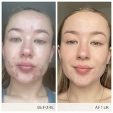 Load image into Gallery viewer, Skin Accumax