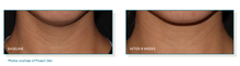 Load image into Gallery viewer, Pep Up® Collagen Boost Face &amp; Neck Serum
