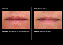 Load image into Gallery viewer, Hyaluronic Acid Lip Booster
